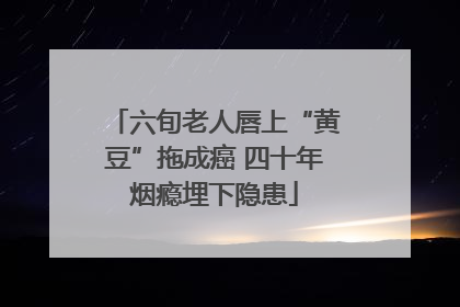 六旬老人唇上“黄豆”拖成癌 四十年烟瘾埋下隐患